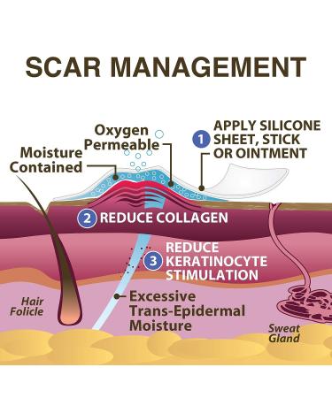Epi-Derm Large Silicone Scar Sheet - 11 x 15.75 in - Natural - Biodermis - Buy Online on GoSupps.com