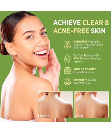 Antifungal Antibacterial Tea Tree Soap: Tea Tree Oil Soap for Face & Body Acne - Antifungal Antibacterial Treatment Soap for Athlete's Foot Tinea Versicolor Folliculitis Ringworm Jock Itch - 2 Pack - Buy Online on GoSupps.com