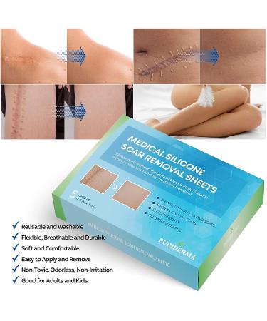Puriderma Medical Silicone Scar Removal Sheets - Set of 5 | Fast & Effective on Keloid, Surgery, Burn, Acne, C-Section Scars - Buy Online on GoSupps.com