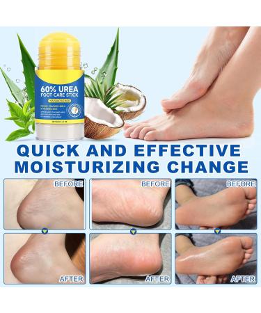  G n rique Foot Cream | Softening Cream for Hard Heels - Moisturizing Repairing Foot Cream | For Travel Back Hip Arm Leg Neck Hand Hard Skin Elbow Daily Use Men Women Winter - Buy Online on GoSupps.com