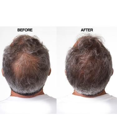 Maximum Strength DHT Blocker Hair Regrowth Conditioner for Men & Women - Stimulates New Follicle Growth for Thicker, Fuller, Longer & Healthier Hair - No Side Effects - Buy Online on GoSupps.com