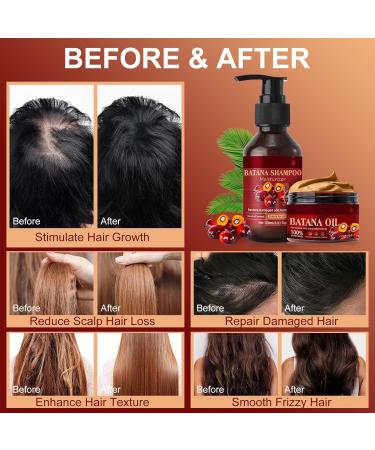 Batana Oil Shampoo et Apr s-shampooing pour la Croissance et la Pr vention de la Chute des Cheveux - Nourrissant pour Cuir Chevelu Sec Shampooing et apr s-shampooing Sets - Buy Online on GoSupps.com