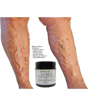 Varicose Veins Balm 120ml - Treatment for Varicose, Spider Veins, Acne, Stretch Marks - Buy Online on GoSupps.com