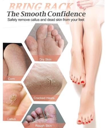 Maryton Natural Pumice Stone for Feet - Foot Exfoliator Scrubber for Dead Skin, Corns, Calluses - Pedicure Tool for Soft Feet and Hands (2 Pack) - Buy Online on GoSupps.com