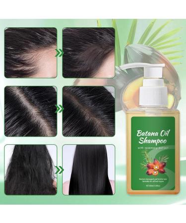 Shampoing Huile de Batana Batana Oil Shampoo pour la Croissance des Cheveux Pr venir la Chute des Cheveux pour Hommes et Femmes Nourrissant Cuir Chevelu sec et Cheveux - Buy Online on GoSupps.com
