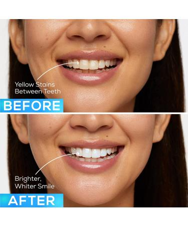 GLO Brilliant Teeth Whitening Gel Treatment Kit - Fast, Pain-Free, Long Lasting Results | 3 Pack - Buy Online on GoSupps.com