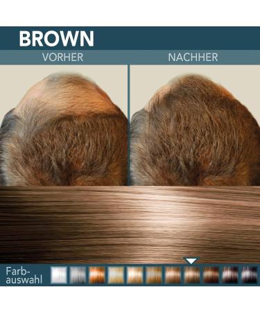 COVER HAIR - Premium Scattered Hair 30 g | Pouring Hair for Hair Thickening and Roots | Authentic Look in for Men and Women | 100% Natural Brown 30 g - Buy Online on GoSupps.com