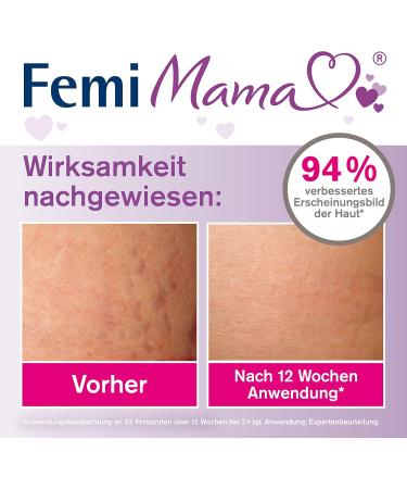 tetesept Femi Mama Stretch Marks Intensive Cream - Reduce & Prevent Stretch Marks - 100 ml - International Shipping Available - Buy Online on GoSupps.com