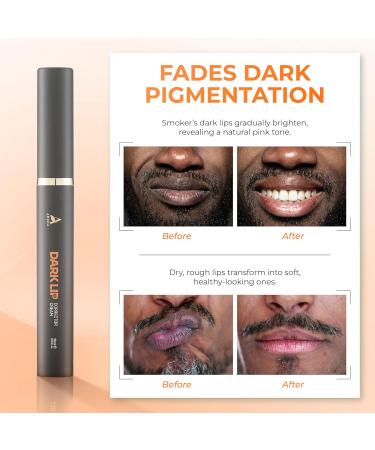 ABERA Dark Lips Corrector Cream, Lip Lightening For Dark Lips For Men & Women, Moisturizing Lip Plumper with Shea Butter - Buy Online on GoSupps.com