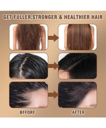 Raw Batana Oil Organic Natural Batana Oil for Hair Growth - 100% Pure Unrefined and Organic for Women & Men Prevent Hair Loss Promote Hair Thickness (120ml) - Buy Online on GoSupps.com