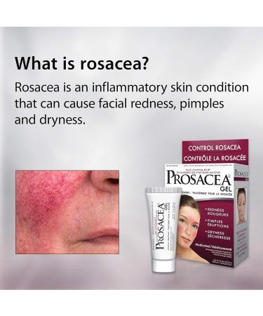 Prosacea Rosacea Treatment Gel - 0.75 oz - Buy Online on GoSupps.com