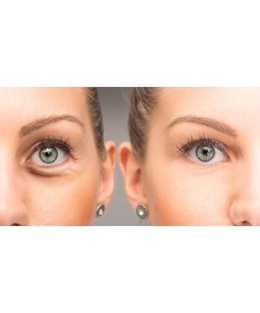 Su-Skin Anti Aging Eye Cream Bright Eyes Daily Wrinkle Cream for Dark Circles & Puffiness | Firming Eye Treatment for Youthful Skin - Buy Online on GoSupps.com