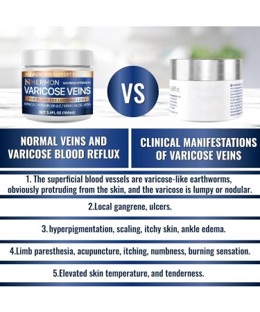 Hermon Varicose and Spider Veins Cream Natural Formula to Improve Circulation Soothe Tired Legs & Reduce Swelling Vein Treatment for Long Standing 3.4 Fl Oz (Pack of 1) - Buy Online on GoSupps.com
