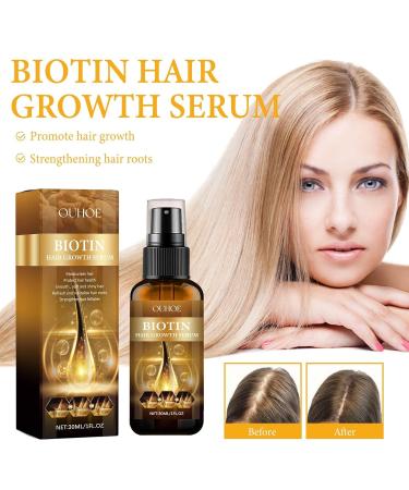 Buy Biotin Hair Growth Spray - 30ml Essential Oil for Fast Hair Growth & Skin Care | Multicolor International Shipping - Buy Online on GoSupps.com