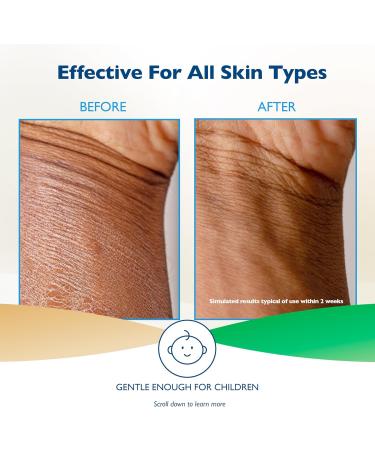Glaxal Base Moisturizing Cream for Itchy Dry Skin & Eczema Relief with Soothing Oatmeal + Aloe Hypoallergenic & Paraben-Free 100g 100 g (Pack of 1) - Buy Online on GoSupps.com