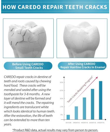 Healing Teeth Crack Toothpaste - Repairing Cracked Teeth Enamel Remineralizing Toothpaste 100g cracked teeth 3.52 Ounce (Pack of 1) - Buy Online on GoSupps.com