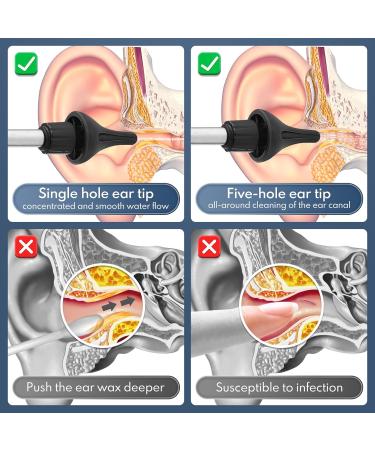 Electric Ear Wax Removal Tool - Safe & Effective Ear Cleaning Kit with 3 Pressure Modes Basin & 8 Tips for Adults & Kids - Home Use International Shipping Available - Buy Online on GoSupps.com