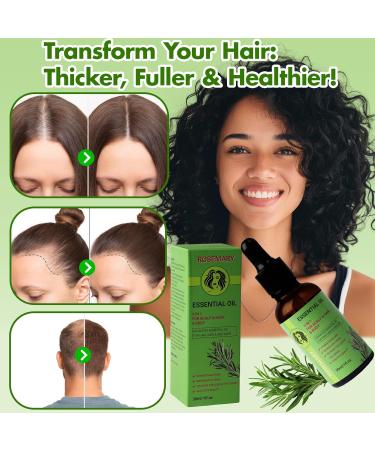 FrexNutri Rosemary Essential Oil for Hair Growth - Rosemary Oil - Non Greasy 30 ML Suitable for Hair Scalp and Body Skin Care Pure and Natural Rosemary Oil for Hair Growth Promotes Fuller - Buy Online on GoSupps.com