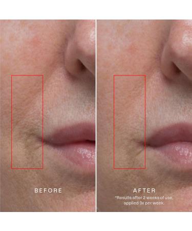 Karuna Age Rewind XL + Standard Duo Pack 8 Single Use Patches - Buy Online on GoSupps.com