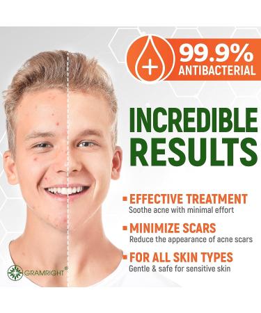 GRAMRIGHT Acne Patches - Natural Hydrocolloid Bandages for Acne Spot Treatment with Salicylic Acid, Hyaluronic Acid, Tea Tree Oil - 120 Pimple Patches - Buy Online on GoSupps.com