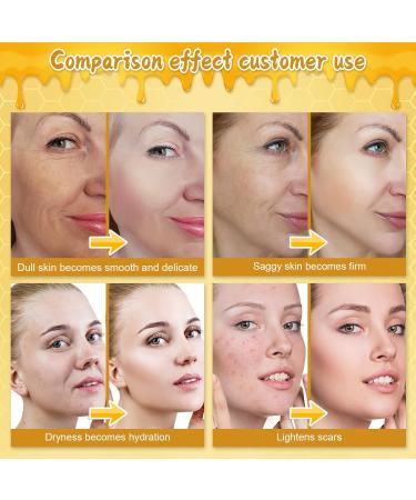 Bee Venom Cream 2025Upgrade 2pcs 60g Multipurpose Bee Venom Skin Treatment Cream for Repair Moisturize and Lift - Buy Online on GoSupps.com