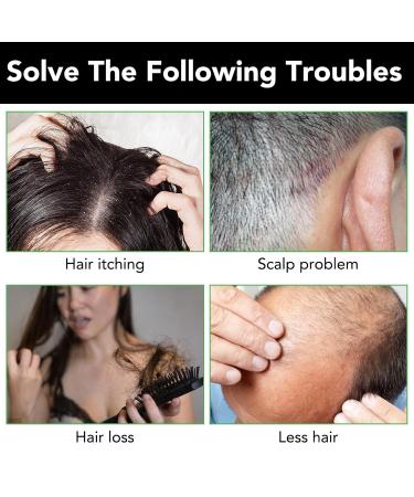 Buy Tiuedu Jamaican Black Castor Oil Shampoo for Thinning Hair - Best Hair Care for Men & Women | Promote Hair Growth - Buy Online on GoSupps.com