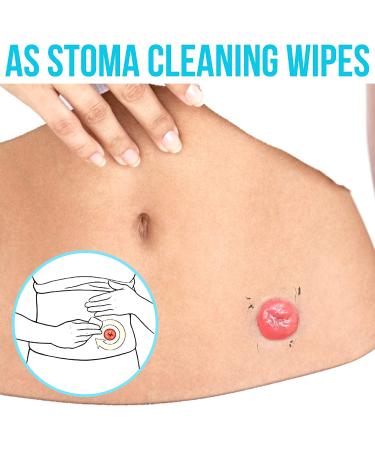 JJ CARE Adhesive Remover Wipes 6x7 - Pack of 50 Count | Sting-Free Medical Adhesive Remover for Ostomy Stoma Devices and Dressings - Buy Online on GoSupps.com