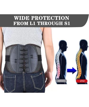 Unlou X-Large Lumbar Belt for Men/Women | Breathable Mesh with Lumbar Pad | Adjustable Posture Correction Waist Back Support - Buy Online on GoSupps.com