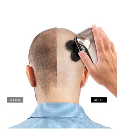 Premium Head Shavers for Bald Men | Wet/Dry Bald Head Razors | Best Head Shaver for a Smooth Shave - Buy Online on GoSupps.com