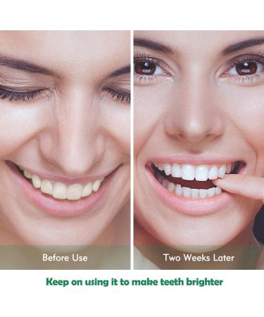 Activated Charcoal Teeth Whitening Powder - Mint Flavor | Natural Stain Fighter Cavity Prevention & Tartar Control | 30g Detoxifier for Dental Care - Buy Online on GoSupps.com