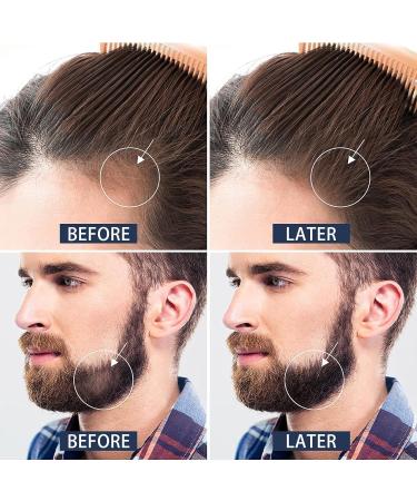 Beard Roller 0.5 mm Beard Roller Dermaroller Beard Roller Beard Growth Micro Needle Roller for Skin and Hair Care for Men and Women - Buy Online on GoSupps.com