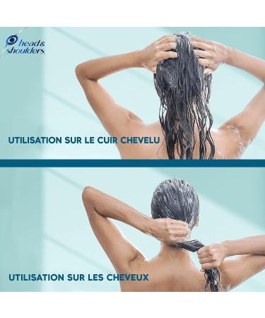 Head & Shoulders DERMAxPRO by Head & Shoulders SOOTHING Conditioner For Dry Hair & Itchy Scalp With Cactus Extract Aloe Vera & Vitamin E 6x200 ml - Buy Online on GoSupps.com