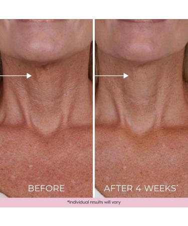 DEKLIDERM Neck Firming Cream Anti Aging Retinol Cream Visibly Reduces Neck Wrinkles and Sagging Neck Cream for loss of Firmness - Buy Online on GoSupps.com