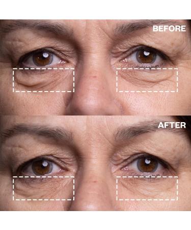 Wrinkles Schminkles Forehead & Under Eye Silicone Patches - Reusable Wrinkle Reducing Set for Smoother Skin Overnight (1 Pair - Buy Online on GoSupps.com