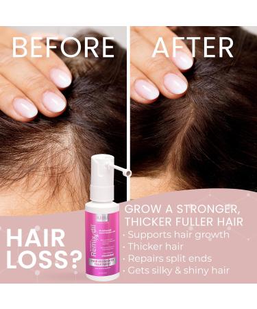 Remixidil Minoxidil 2% Hair Growth Spray for Women - Thinning Hair Regrowth & Thickening Treatment | Fast International Shipping - Buy Online on GoSupps.com