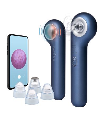 Emay Plus Visual Facial Blackhead Vacuum Cleaner with Cooling and Heating Compress Functions  10X Real Time Camera Monitoring Pore Cleaner with 4 Interchangeable Heads