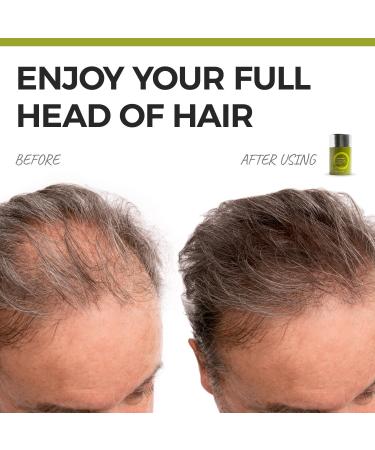 Hair Powder for Thinning Hair - Instant Root Concealer | Wind & Sweat Resistant | 60g Black - Hide Thin Hair & Scalp Shine in 30 Seconds - Buy Online on GoSupps.com