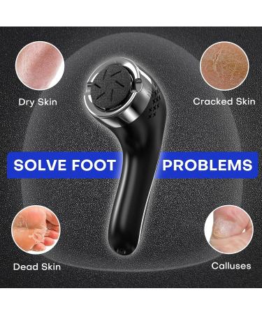 Electric Callus Remover with Dander Vacuum Cleaner | Professional Pedicure Tools Kit with 3 Rollers, 2 Speeds & LCD Display | Powerful Foot File for Dead Skin Removal - Foot Care Essential - Buy Online on GoSupps.com