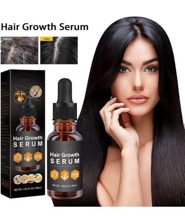 Hair Growth Serum for Black Women Hair Growth Oil New Hair Growth Serum Anti Hair Loss Nourishes Dry and Damaged Hair - Buy Online on GoSupps.com