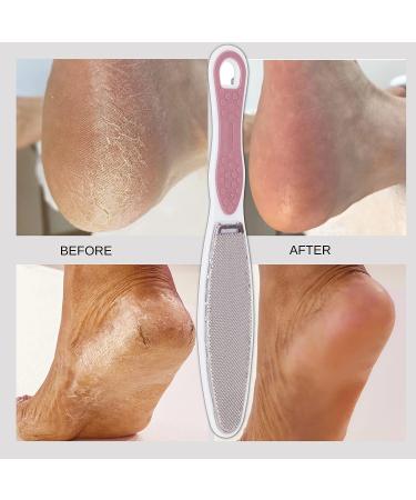 Wonder Pedi Double-Sided Foot File - Emery & Stainless Steel Callus Remover for Feet - Professional Foot Scrubber Dead Skin & Heel Scraper - Foot Rasp for Cracked Heels Repair - Buy Online on GoSupps.com