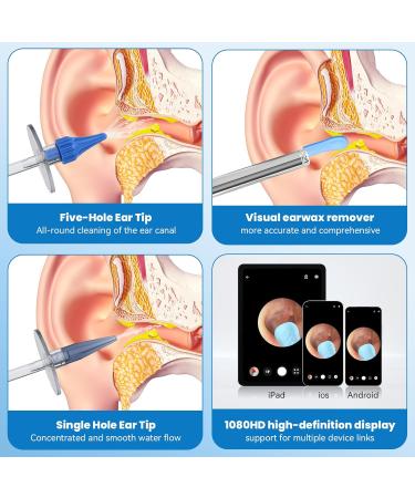 Ear Wax Removal - Ear Cleaner - Ear Camera - FSA HSA Eligible - Ear Wax Removal Kit - Ear Wax Removal Tool Camera - 1080HD Effective for Cleaning Ear Wax Build-Up - Buy Online on GoSupps.com