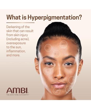 Ambi Even & Clear Fade Serum Hyperpigmentation Treatment Hydroquinone-free Dark Spot Corrector Results In As Little As 4 Weeks Retinol Hyaluronic Acid Niacinamide Ceramides 1 Fl Oz - Buy Online on GoSupps.com