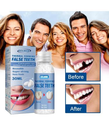 Provisional Denture Adhesive Set | Temporary Dental Repair Kit & Instant Veneers for Provisional Teeth - Buy Online on GoSupps.com