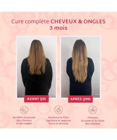 Mium Lab - 3 Month Program - Growth & Fortification for Hair and Nails - Clinically Tested & Highly Dosed (10000% Biotin) | Gummies Red Fruit Flavor Sugar Free | Made in France - Buy Online on GoSupps.com
