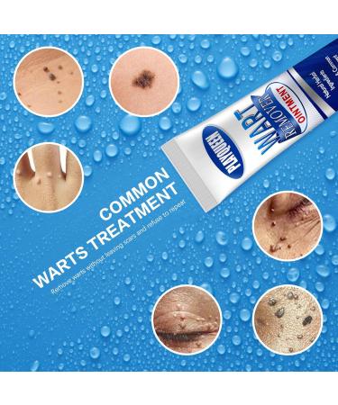 Fast Acting Wart Remover Ointment | Maximum Strength Wart Gel with Salicylic Acid | Effective Treatment for Common Plantar & Genital Warts - International Shipping Available - Buy Online on GoSupps.com