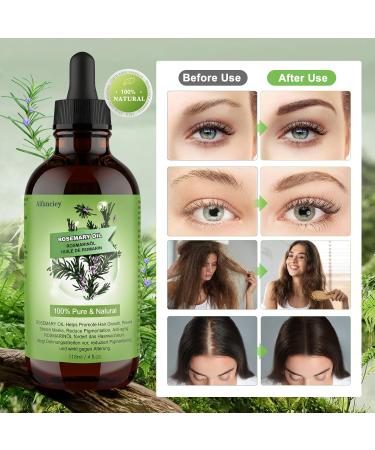 Rosemary Oil for Hair - Rosemary Oil for Hair Growth - 100% Natural - For Scalp - Accelerate Hair Growth - Scalp Oil - Oil - Buy Online on GoSupps.com