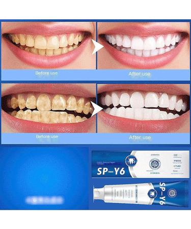 Prediotics Whitening Toothpaste with Probiotics - SP-Y6 for Healthy Teeth & Gums (1pc) - Best International Shipping - Buy Online on GoSupps.com