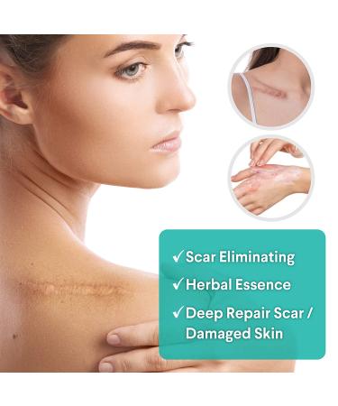 Scar Removal Cream for Old Scars - Stretch Mark & Burn Repair - Face Skin Repair 1oz - Buy Online on GoSupps.com