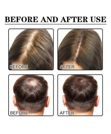 4PCS Allurium Hair Growth Serum for Black Women - Fast Natural Hair Growth & Repair | Anti Hair Loss Treatment - Buy Online on GoSupps.com