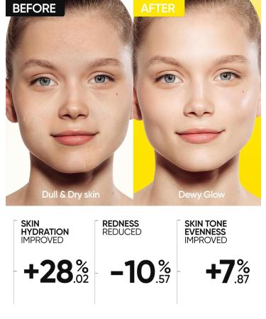 SKINTIFIC Radiance Booster Serum Spray Hydrating Face Mist with Bifida Ferment & Squalane Glow Serum for Radiant Skin Soothes Skin Vegan Skin Care All In One Mist 3.3 fl oz - Buy Online on GoSupps.com